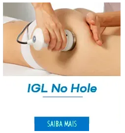 IGL No-Hole